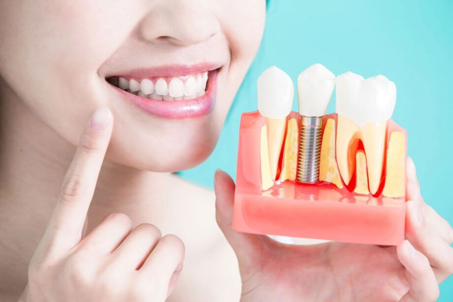 Loop Perio - Periodontics and Implants