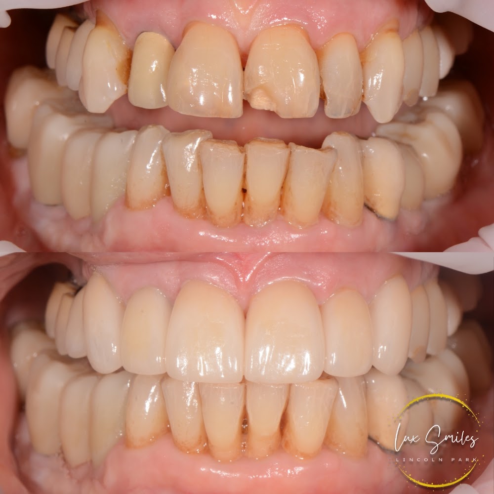 Lux Smiles Cosmetic Dentistry and Prosthodontics