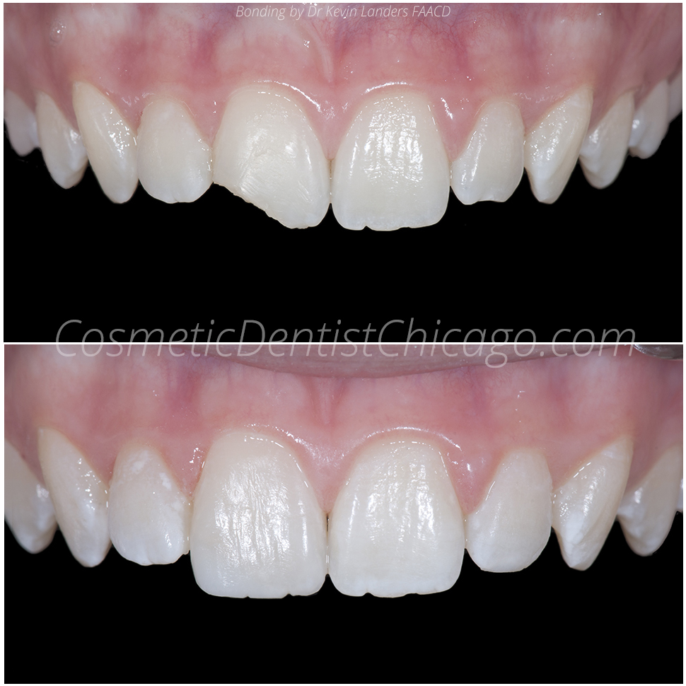 Advanced Cosmetic & Implant Dentistry