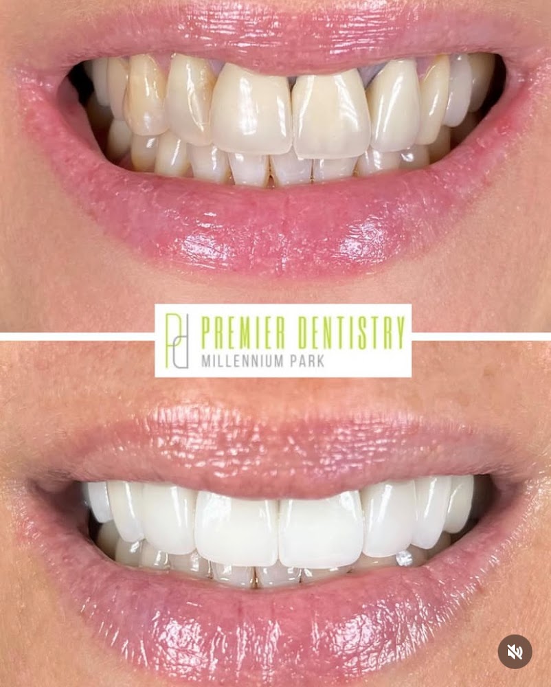 Premier Dentistry at Millennium Park